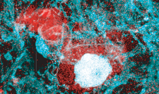 Microglia in red phagocytosing a glioma cell in blue