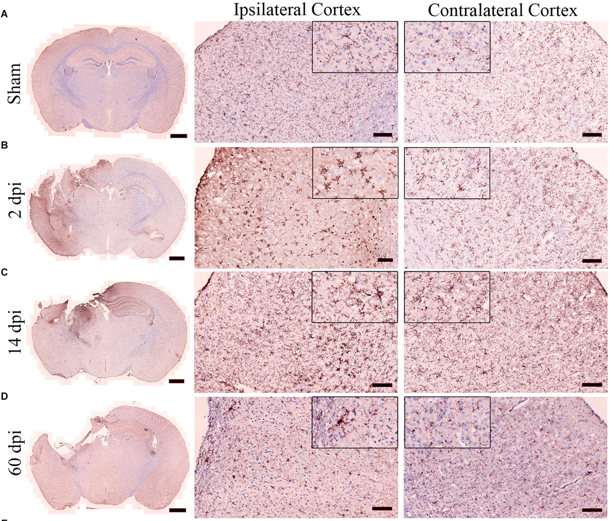 Figure showing the time-dependent progression of immune responses after traumatic brain injury